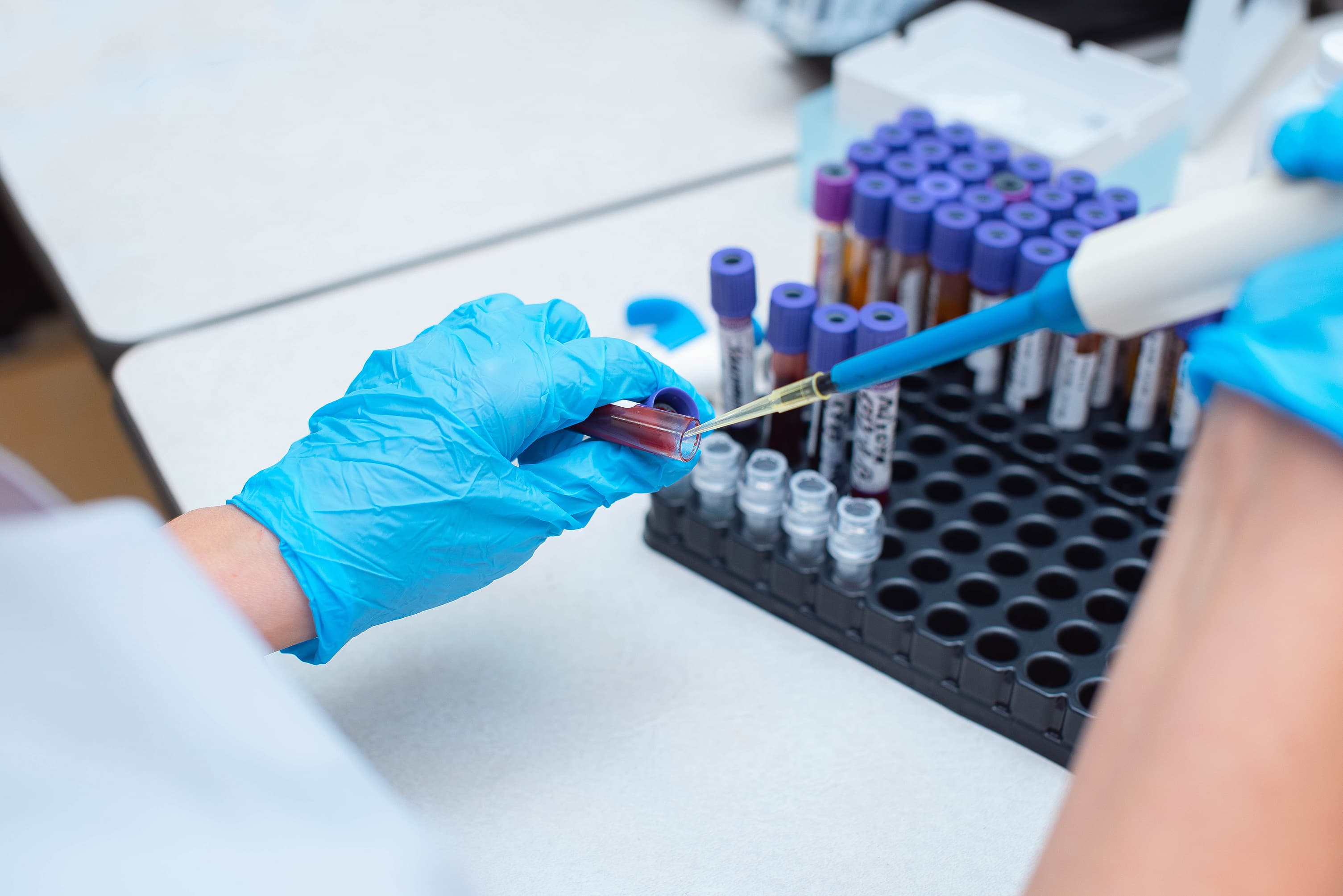 Gesundheits-Check & Risikobewertung Hormonanalyse