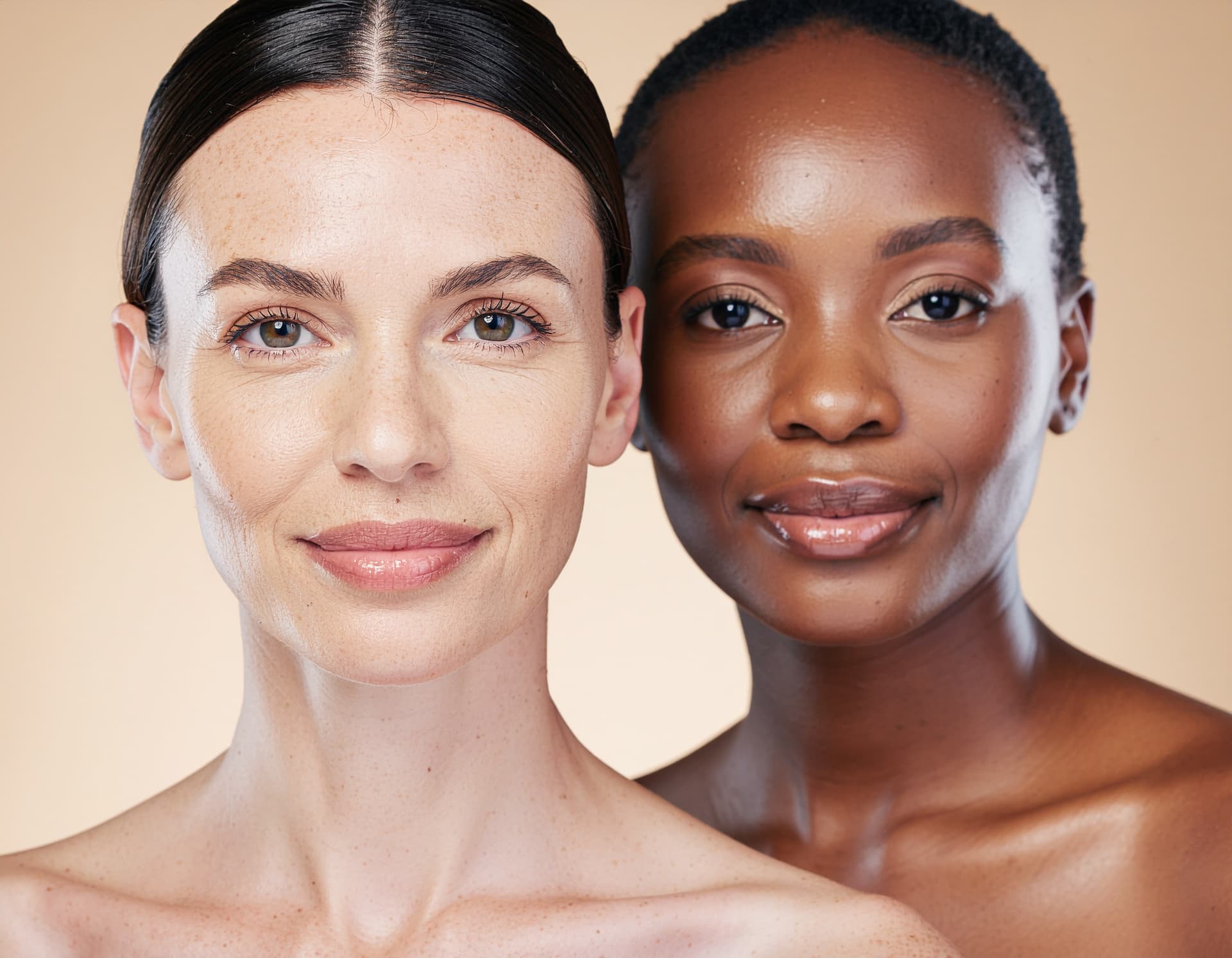 Facelift (Rhytidectomy)